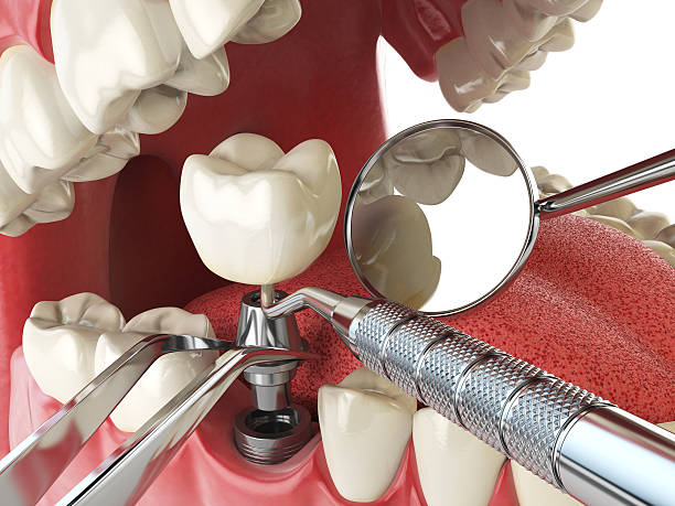 Best Emergency Dental Surgery in Scobey, MT
